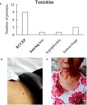 The safety and efficacy of PD-1 inhibitors in patients with advanced cancers and HIV/AIDS in China